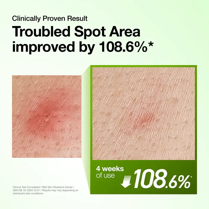 Anua Azelaic Acid 10+ Hyaluron Redness Soothing Serum 10ml - Image 4