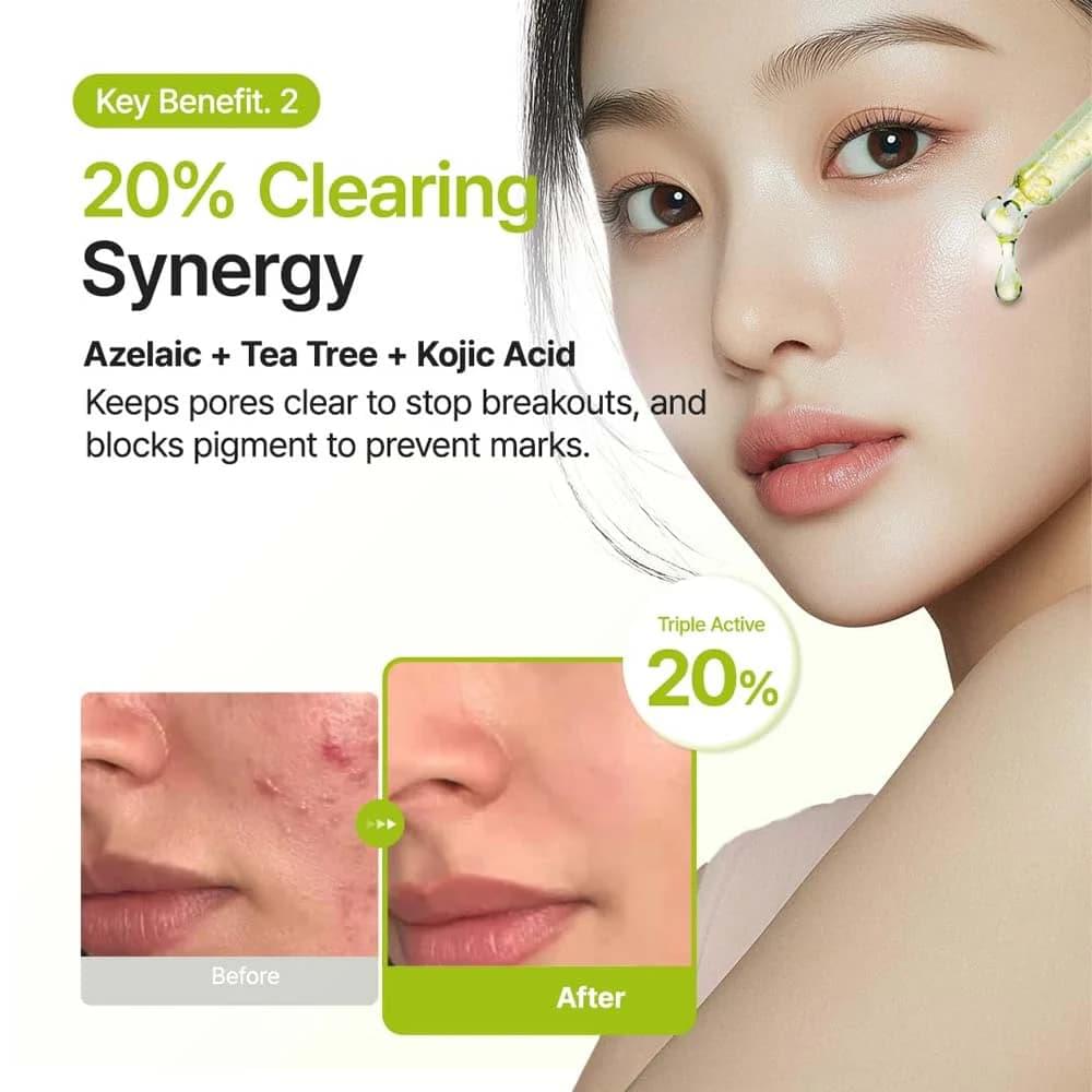 PURITO Azelaic Acid 10% Serum – A lightweight facial serum with Azelaic Acid, Kojic Acid, and Tea Tree to help calm redness, improve skin clarity, and support blemish-prone, oily, and sensitive skin. 30 mL / 1.01 fl. oz. - Image 2